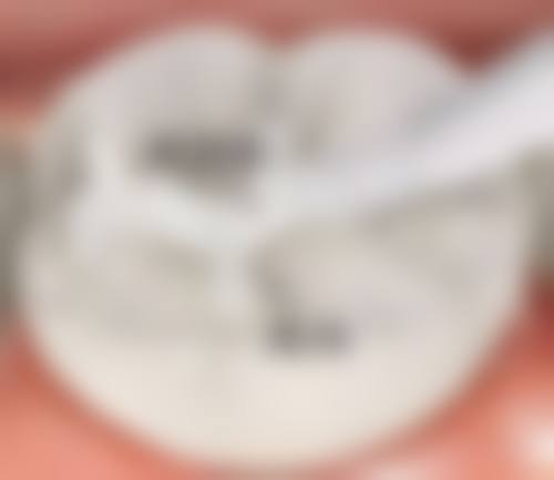 【无棣小马口腔诊所常见问题解答(FAQ)】
