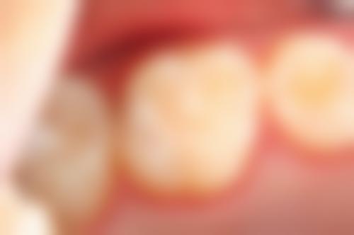 【无棣小马口腔诊所真实口碑评价】