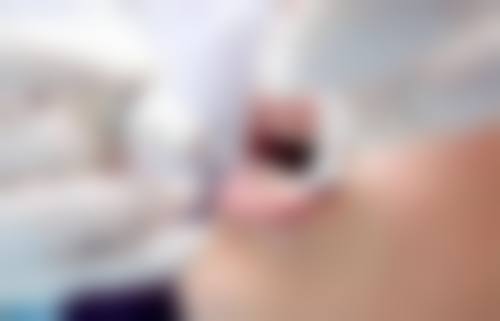 【江苏连云港安觅口腔特色诊疗项目】