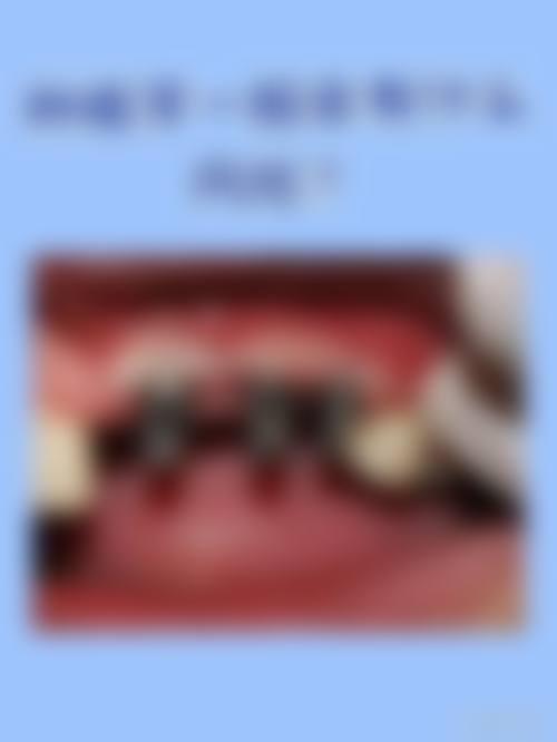 【山东济南润甜口腔预约挂号方式】