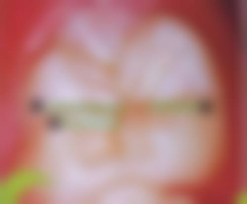 【淮南一诺口腔诊所真实口碑评价】