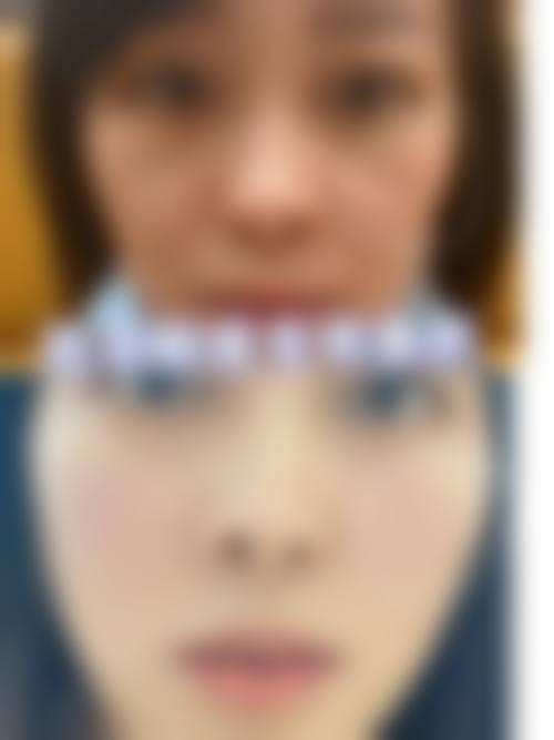 优惠活动详情:眼部整形原价12800元,优惠价6800元