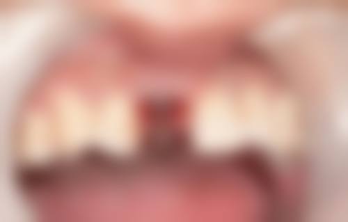 【常熟明日口腔特色诊疗项目】