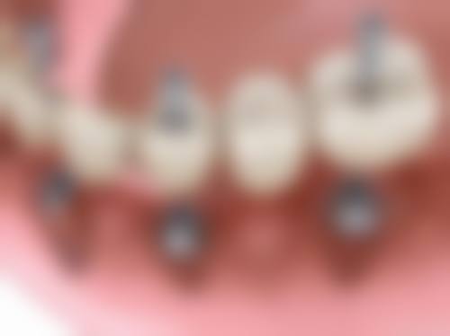 【赣州唯乐美口腔医院预约挂号方式与流程】