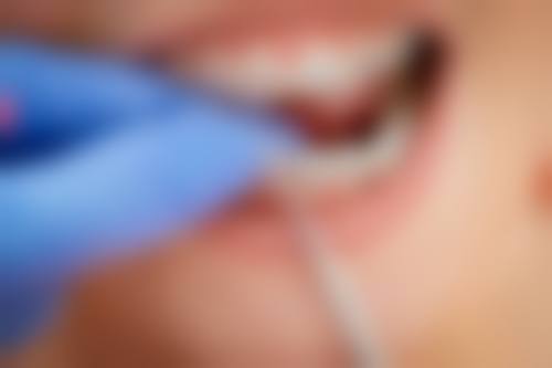 【宁明钰齿口腔特色诊疗项目】