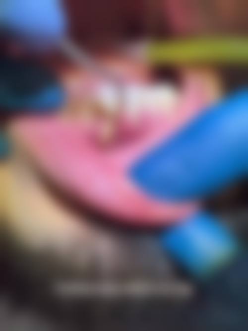 【甘肃凉州区惠诺口腔参考价格表】