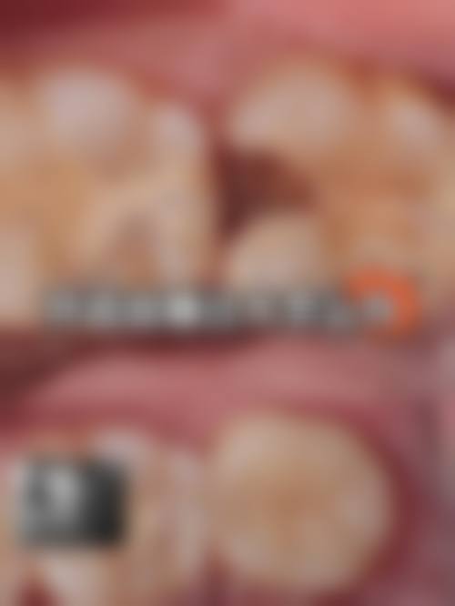 【广东河源康华口腔真实口碑评价】