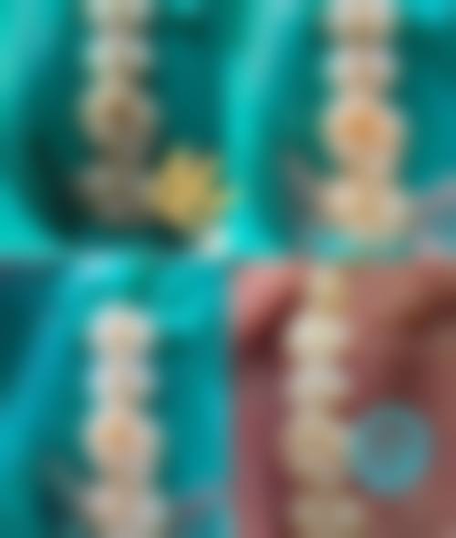 【长春传阳口腔门诊部真实口碑评价】