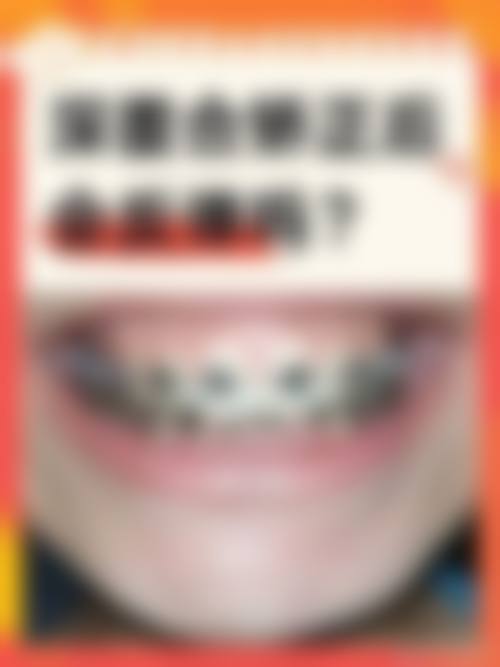 【广东河源恒雅口腔预约挂号方式与流程】