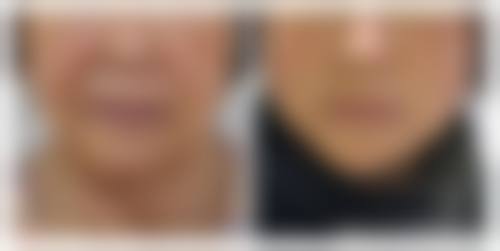 擅长项目详解