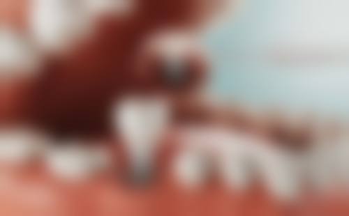 【深圳吴定理口腔诊所交通路线与周边停车指南】
