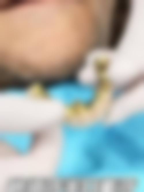 【江苏南通牙爵士口腔常见问题解答FAQ】