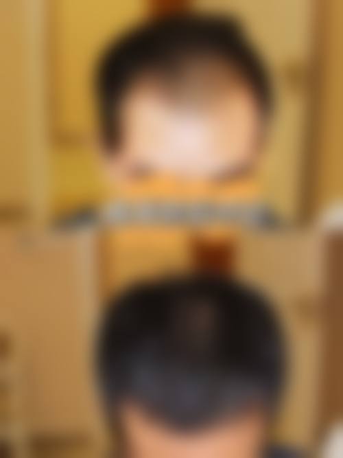 结尾预约号召:立即预约张明琴医生