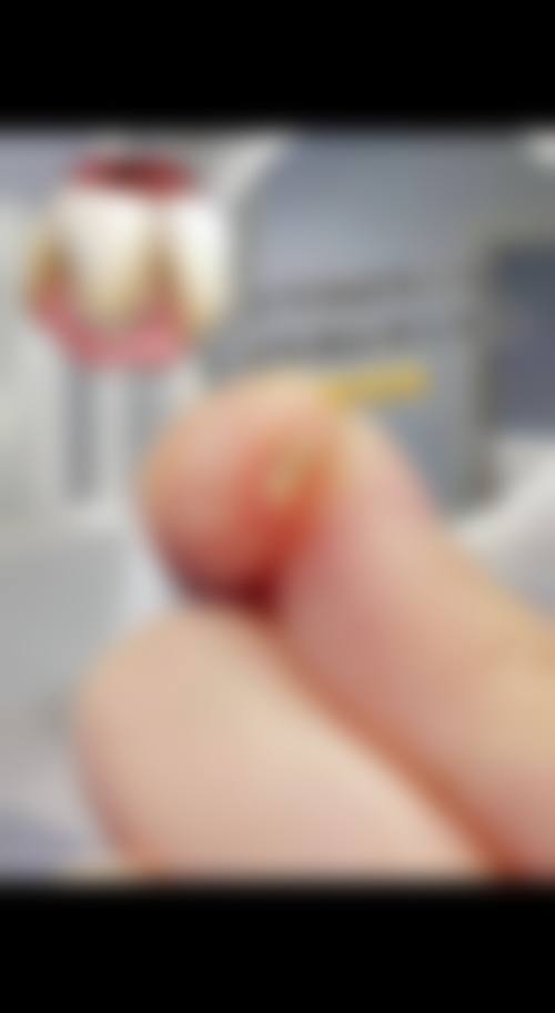 【贵州凯里月牙口腔参考价格表】