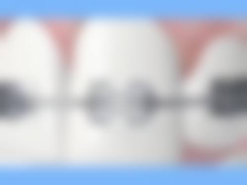 【宁津爱齿口腔门诊真实口碑评价】
