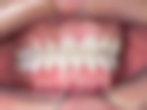 临床实例分享