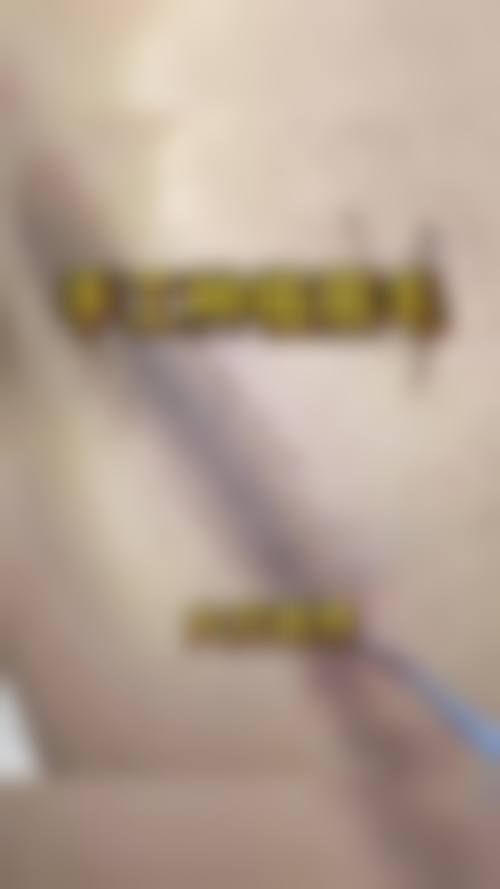 预约优惠活动:现在预约李震医生有哪些补贴?
