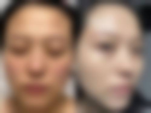 擅长项目详解