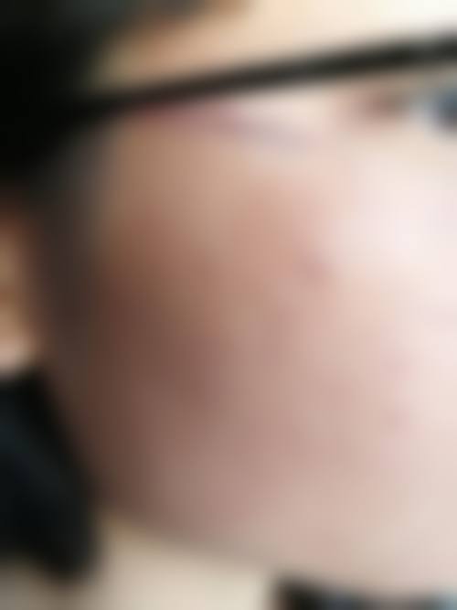 患者真实评价:求美者口中的李震医生