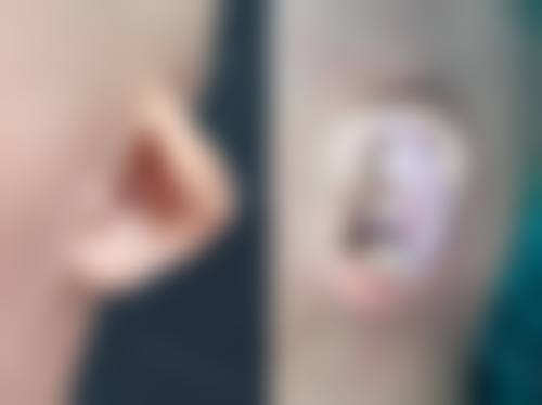 擅长项目详解:李震医生能为你做什么?