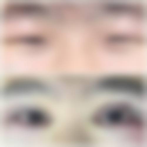 临床实例分享