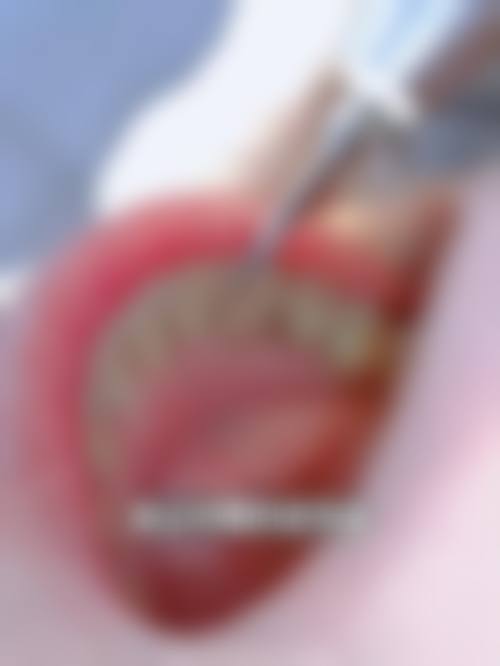 【湘潭岳塘章佩良口腔诊所真实口碑评价】