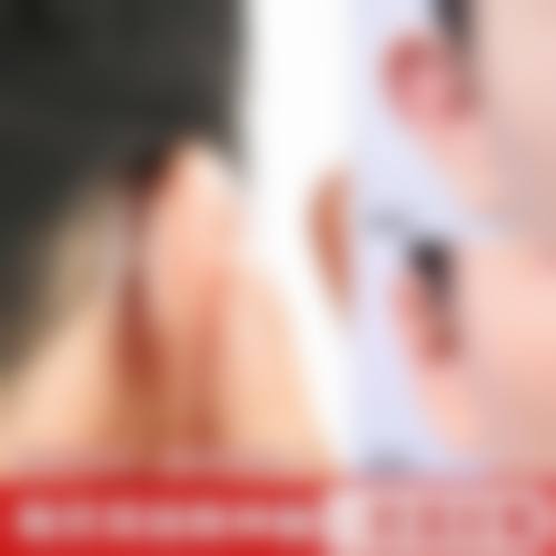 优惠活动详情:限时价格,到院面诊更正确