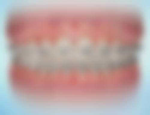 【雅至口腔诊所交通路线与周边停车指南】