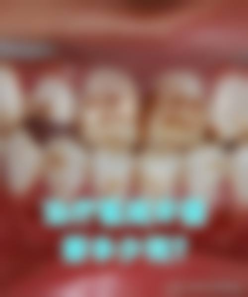 优惠活动详情