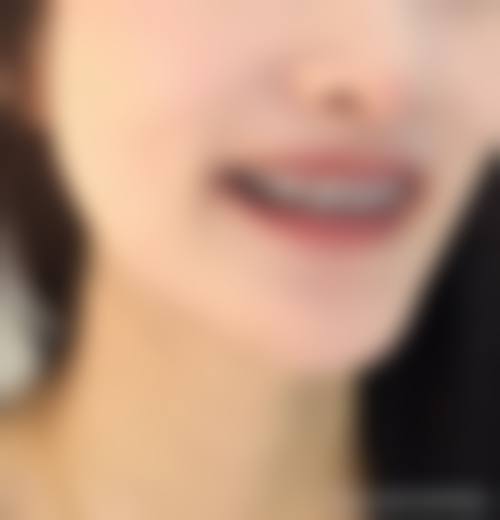特色科室与项目——全方面口腔诊疗方案