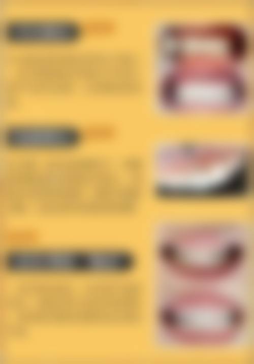 【广州瑞博口腔(四海城店)参考价格表】