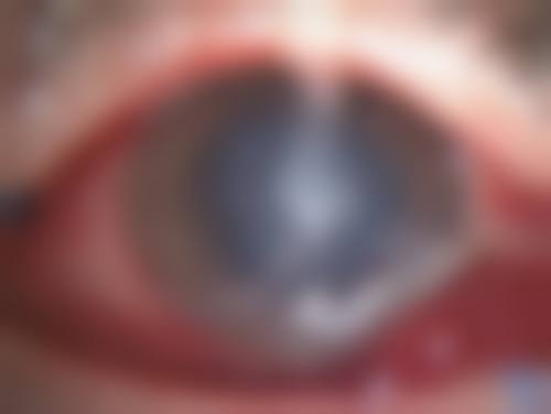 患者真实评价:符强医生的口碑好不好?