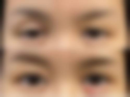 诊疗特色总结:为什么符强医生能取得这么多成功实例?