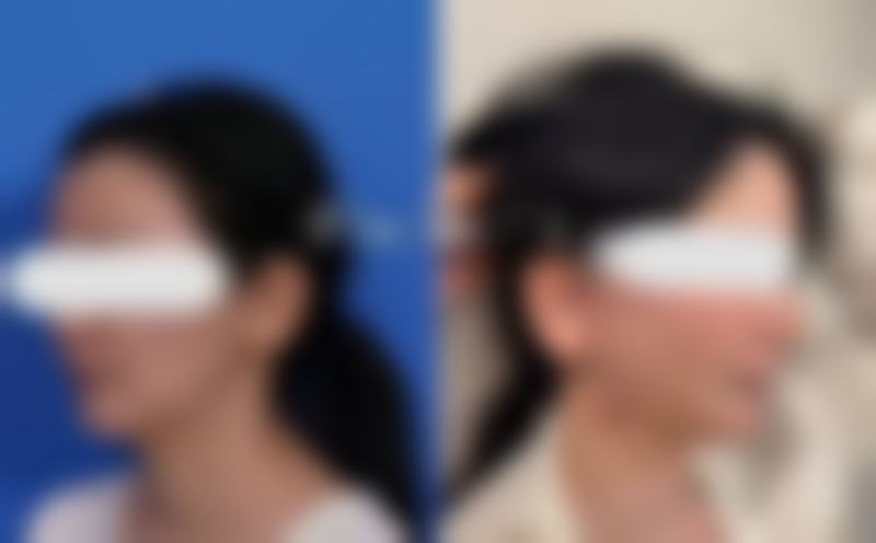总结:选择IAM,开启安心变得更美之旅