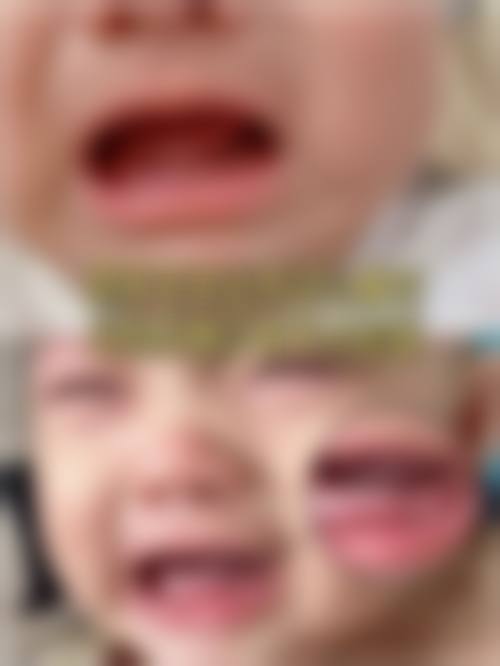擅长项目详解 - 芜湖来友口腔门诊部张来友