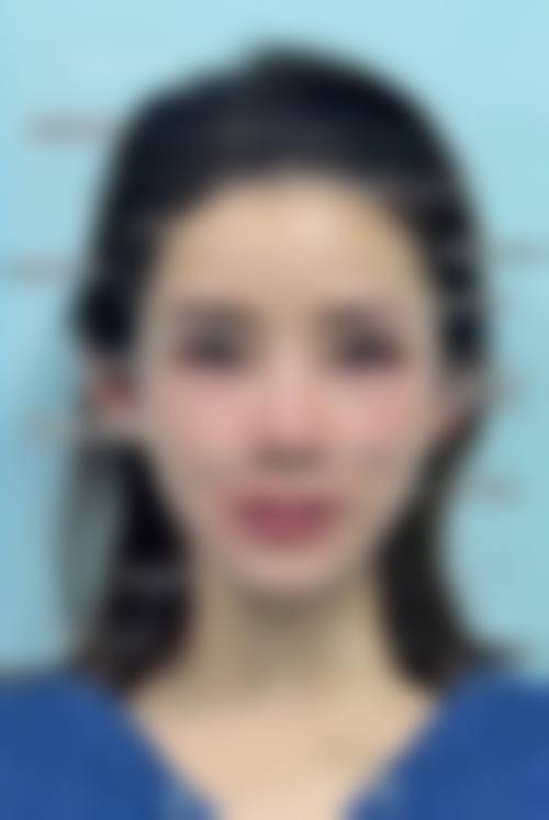预约优惠活动