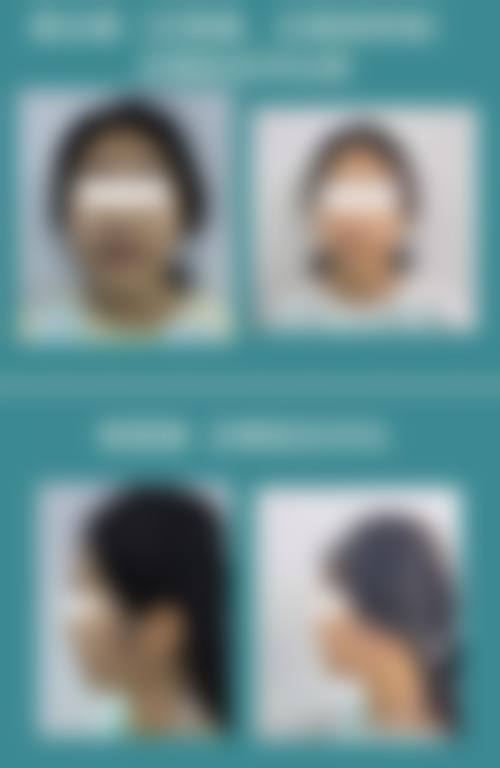优惠活动详情