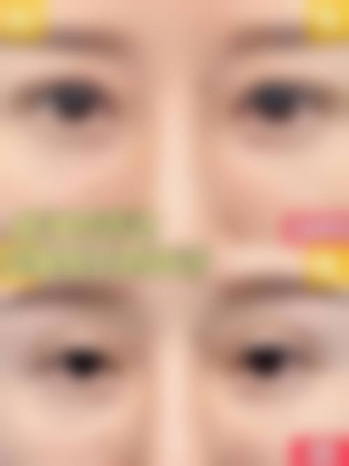 临床实例分享