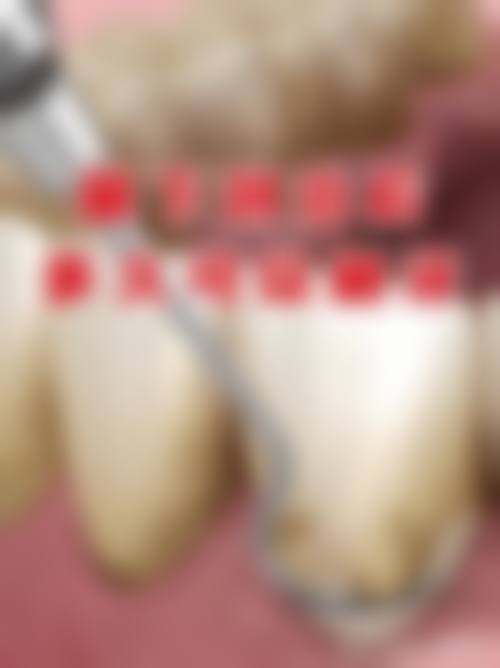 【江西上饶弋阳楼氏口腔常见问题解答FAQ】