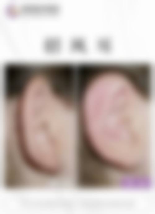 优惠活动详情:面部综合整形原价59800元-优惠价39800元