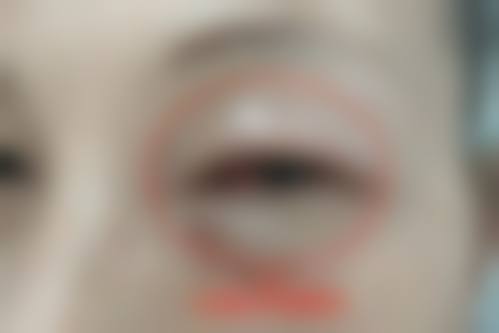 患者真实评价:余才翰医生的口碑怎么样?