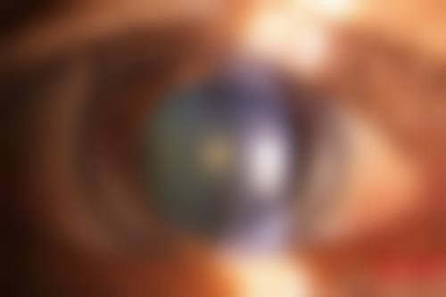 结尾预约号召:立即行动,守护眼健康