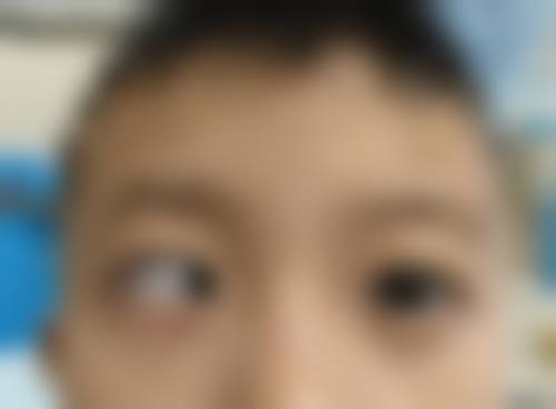 特色科室与项目:白内障与近视激光是优势