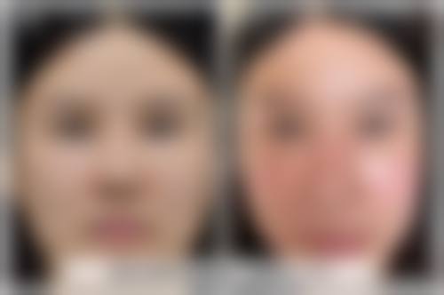 特色科室与项目:卿晓玲、李婧君医生领衔的面部年轻化手术