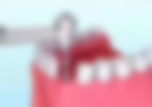 【韶关仁化健民口腔真实口碑评价】
