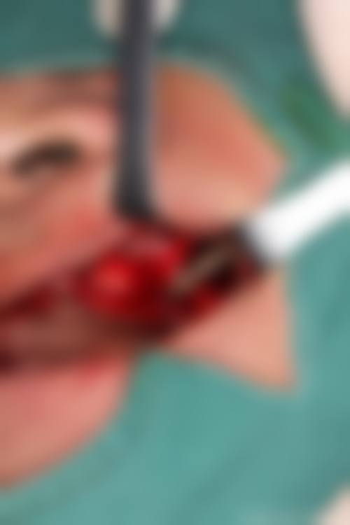 【琼海光华海医口腔门诊部骨干医生团队与技术标准】