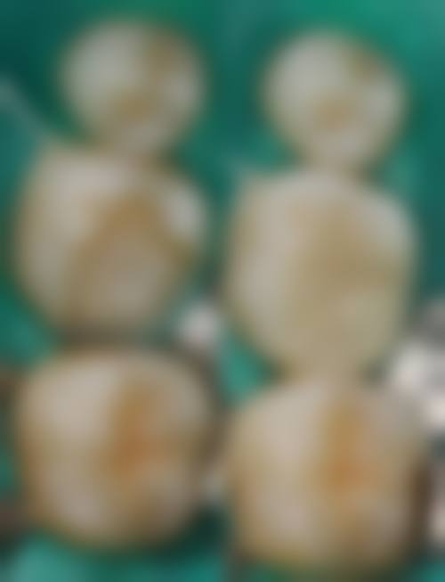 近期优惠活动与便捷预约方式