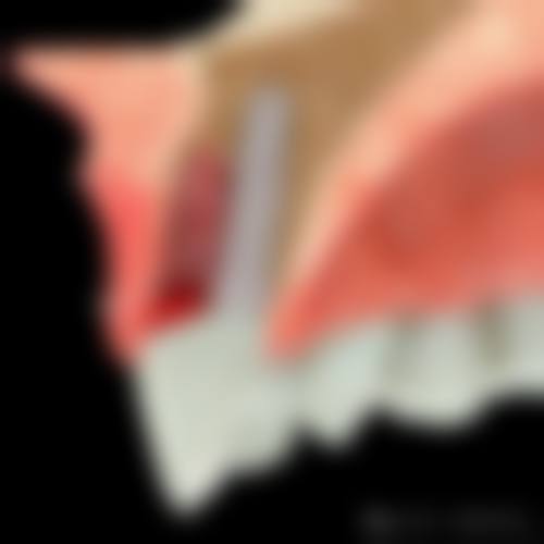 【辽宁大连张敏口腔诊所参考价格表】