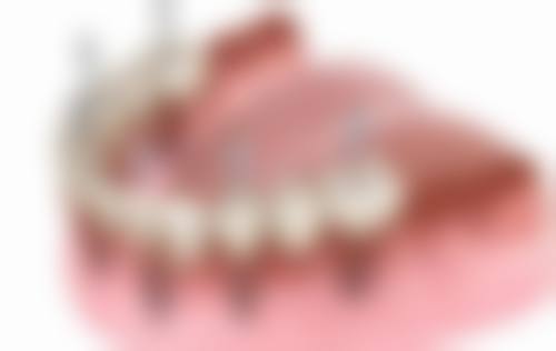 【旌阳德口口腔门诊部常见问题解答FAQ】