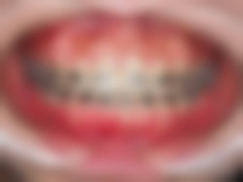 【广西牙精英口腔交通路线与周边停车指南】